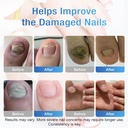 toenail-fungus-treatment-extra-strength--5.jpg