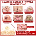 toenail-fungus-treatment-extra-strength--3.jpg