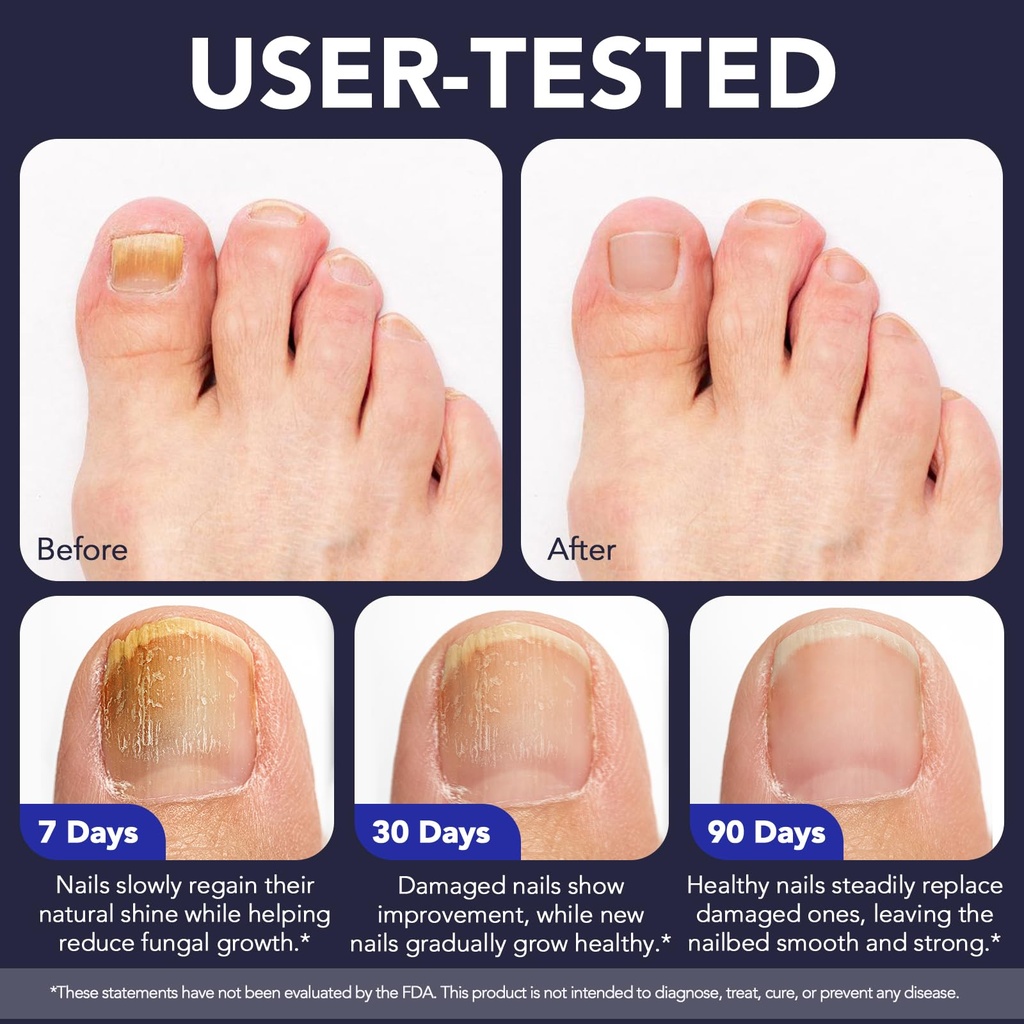 toenail-fungus-pen-toenail-treatment-ext-6.jpg