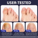 toenail-fungus-pen-toenail-treatment-ext-6.jpg