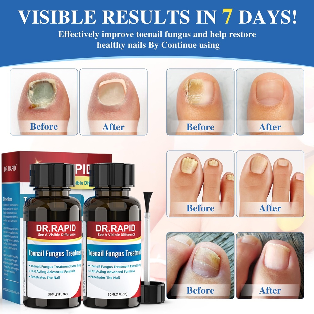 toenail-fungus-treatment-extra-strength--2.jpg