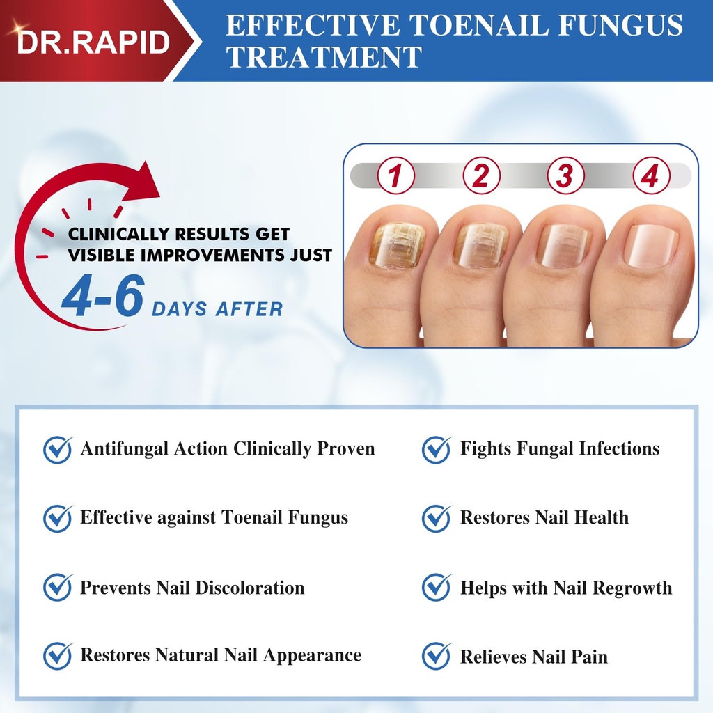 toenail-fungus-treatment-extra-strength--4.jpg