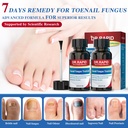 toenail-fungus-treatment-extra-strength--3.jpg