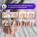 toenail-fungus-treatment-extra-strength--5.jpg