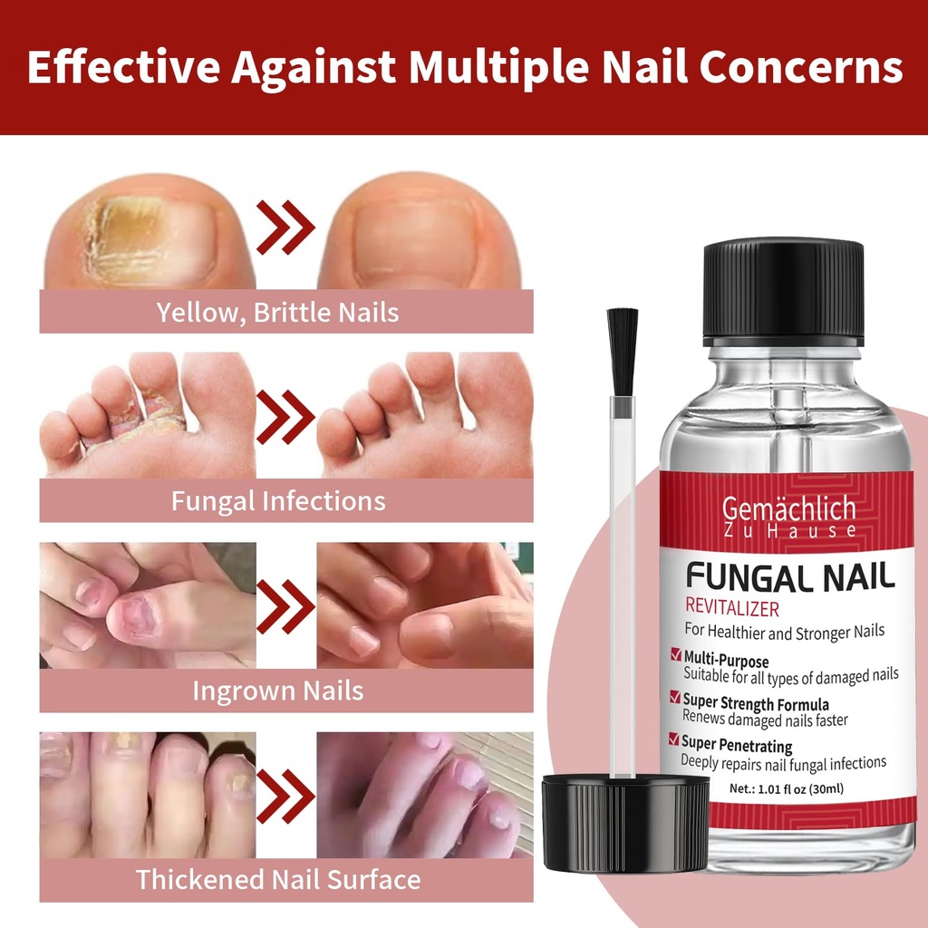 toenail-fungus-treatment-extra-strength--4.jpg