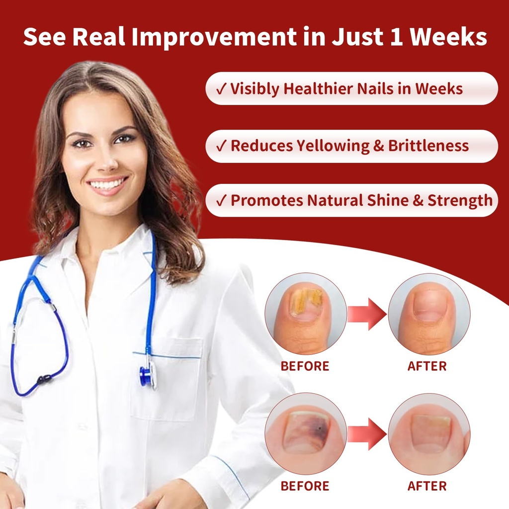 toenail-fungus-treatment-extra-strength--5.jpg