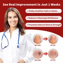 toenail-fungus-treatment-extra-strength--5.jpg