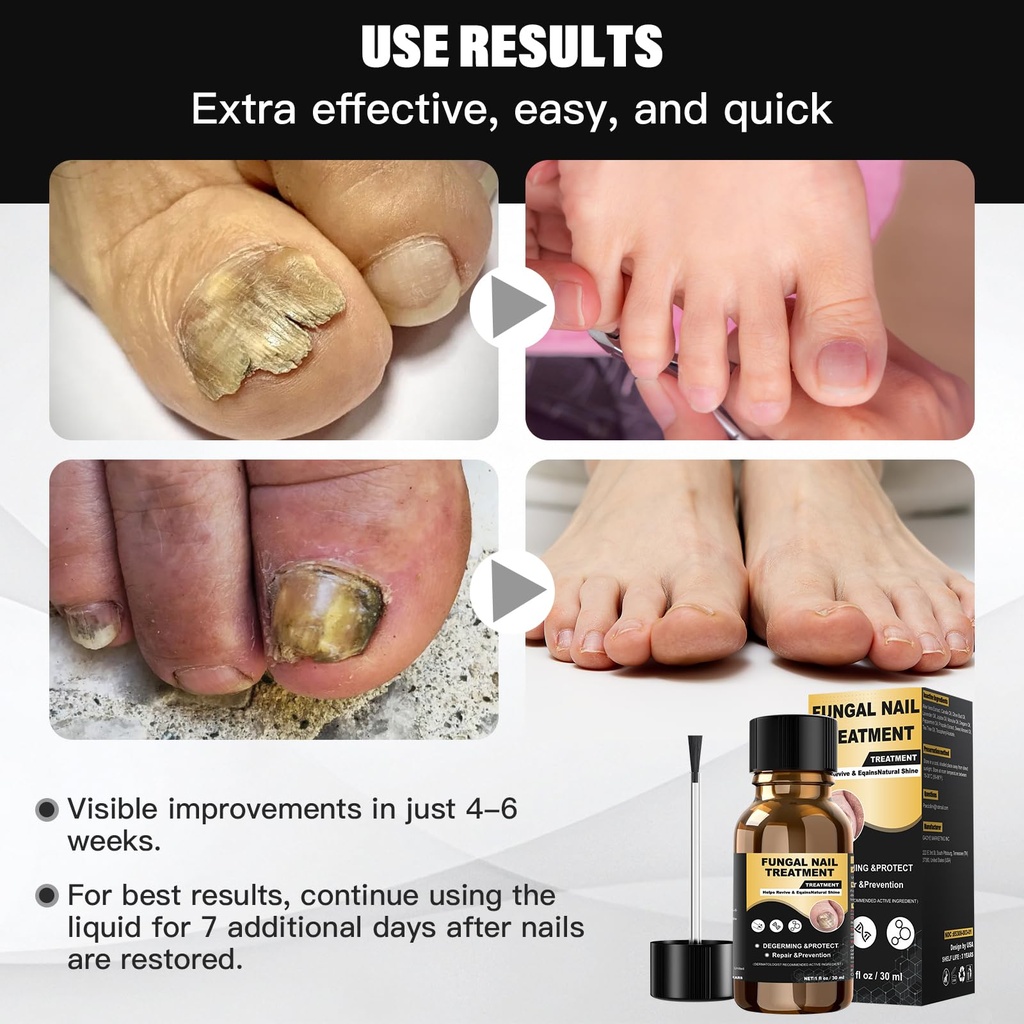 toenail-fungus-treatment-foot-fungus-tre-6.jpg