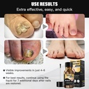 toenail-fungus-treatment-foot-fungus-tre-6.jpg