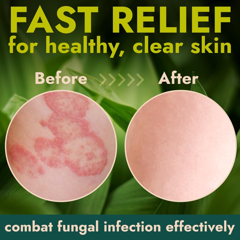 terramed-just-think-comfort-antifungal-b-5.jpg