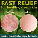 terramed-just-think-comfort-antifungal-b-5.jpg