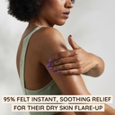 aveeno-eczema-therapy-rescue-relief-trea-5.jpg