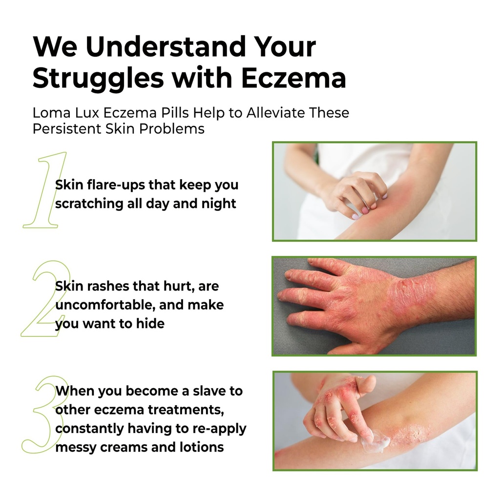loma-lux-eczema-pills-natural-eczema-tre-4.jpg