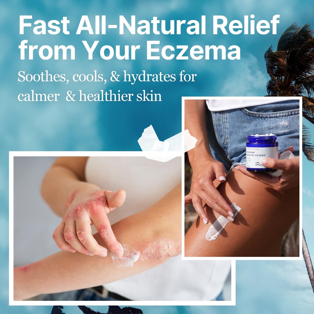 the-ocean-healed-my-eczema-natural-sooth-4.jpg