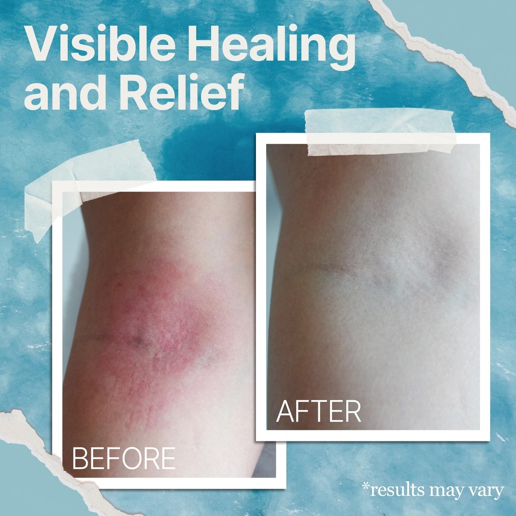 the-ocean-healed-my-eczema-natural-sooth-5.jpg