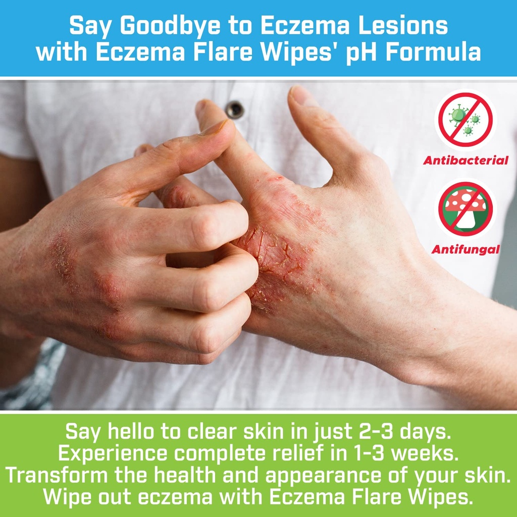 eczema-flare-wipes-all-natural-fast-acti-5.jpg