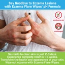 eczema-flare-wipes-all-natural-fast-acti-5.jpg