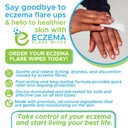 eczema-flare-wipes-all-natural-fast-acti-2.jpg