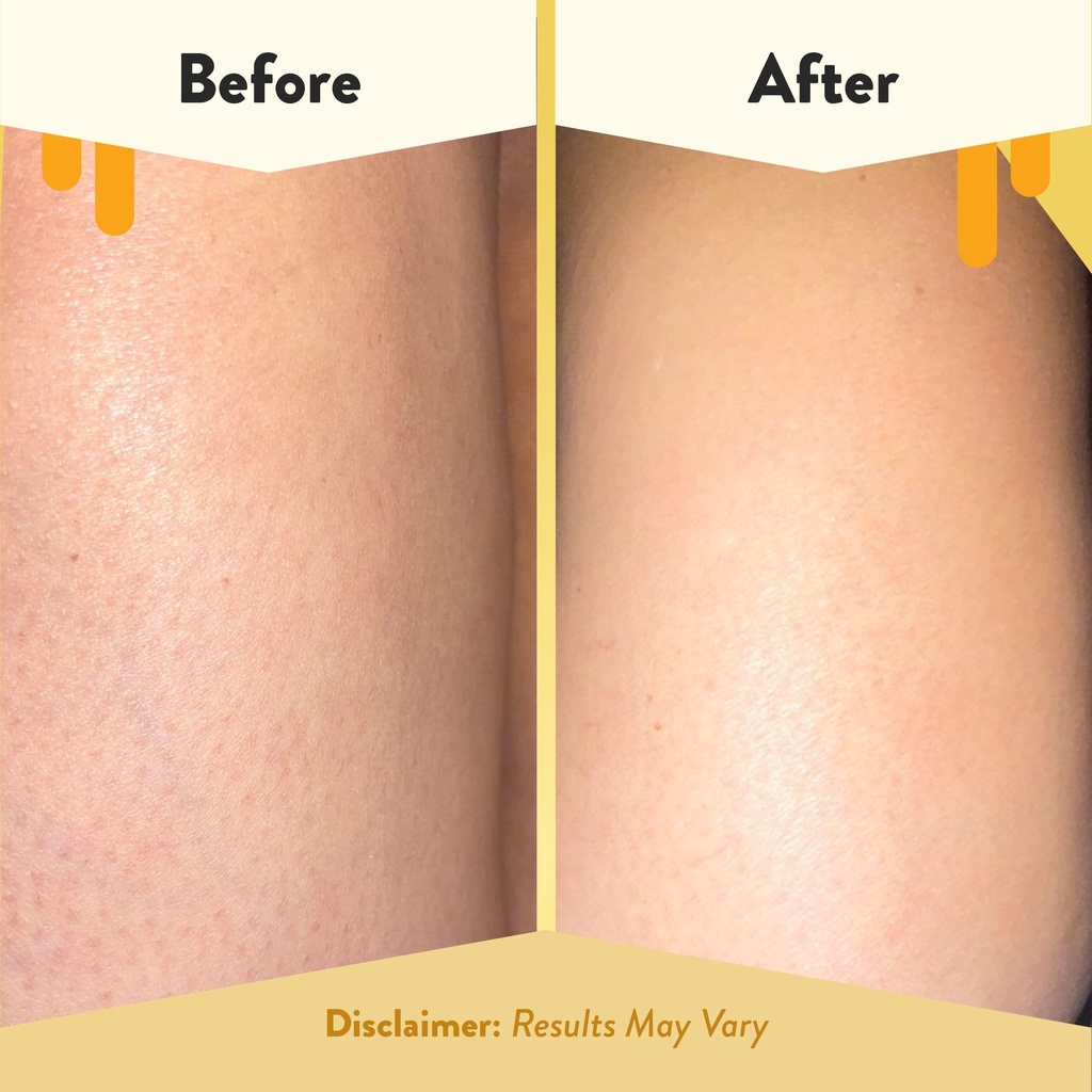 eczema-honey-soothing-body-wash-daily-sh-4.jpg