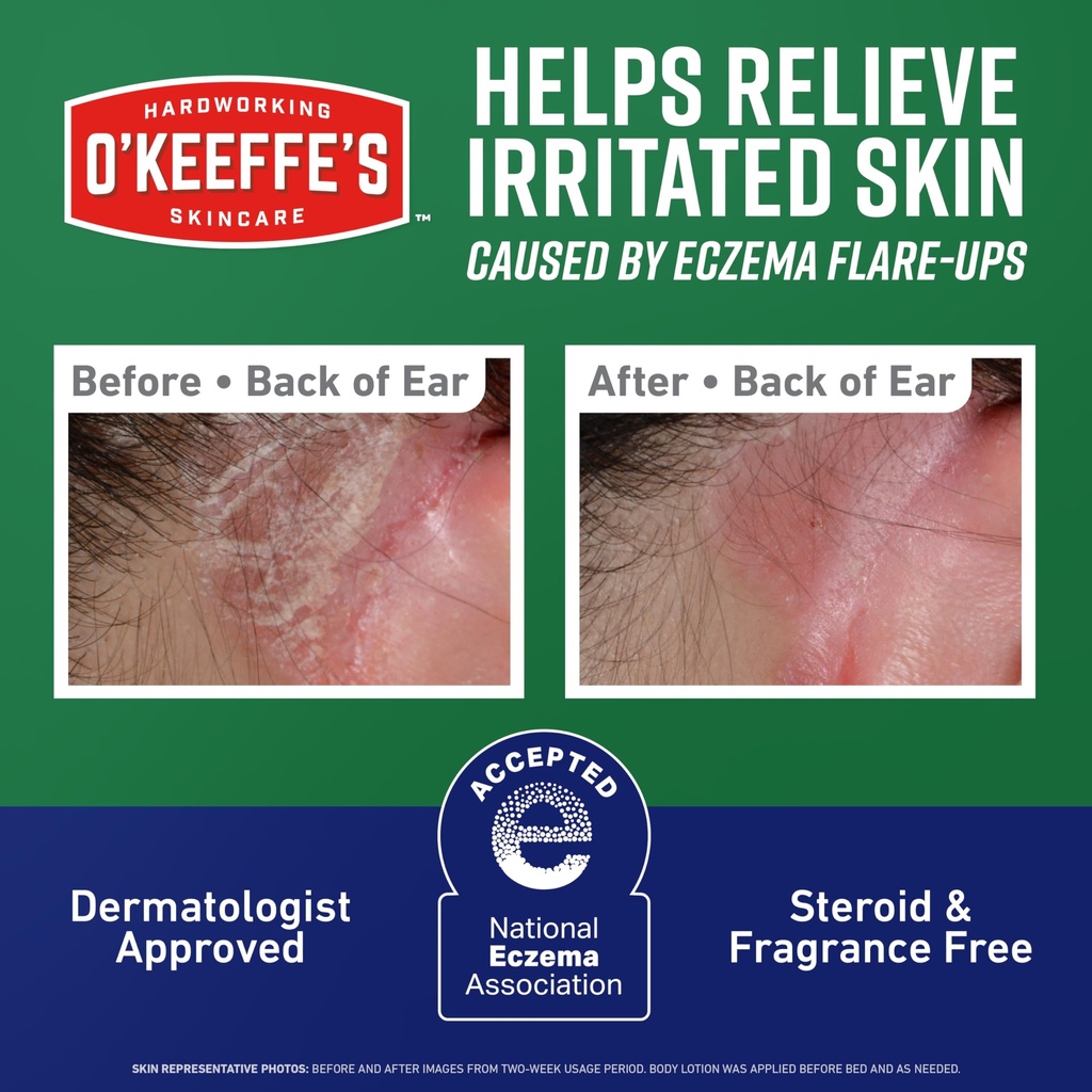 o-keeffe-s-skin-repair-eczema-relief-bod-3.jpg