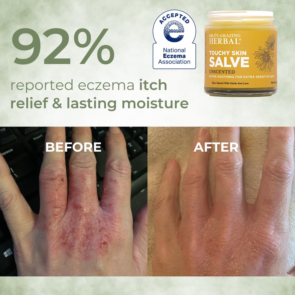 ora-s-amazing-herbal-touchy-skin-salve-e-2.jpg