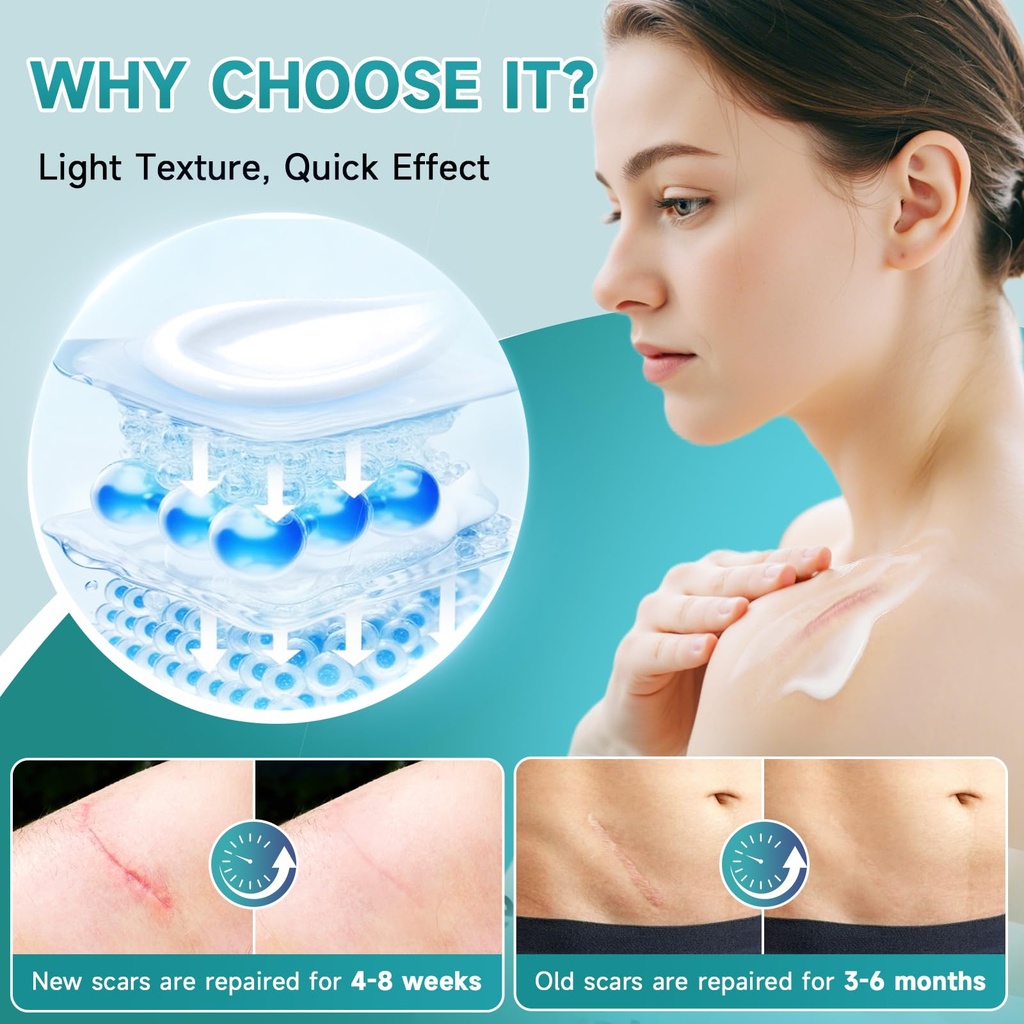 pumkot-advanced-scar-cream-silicone-gel--5.jpg