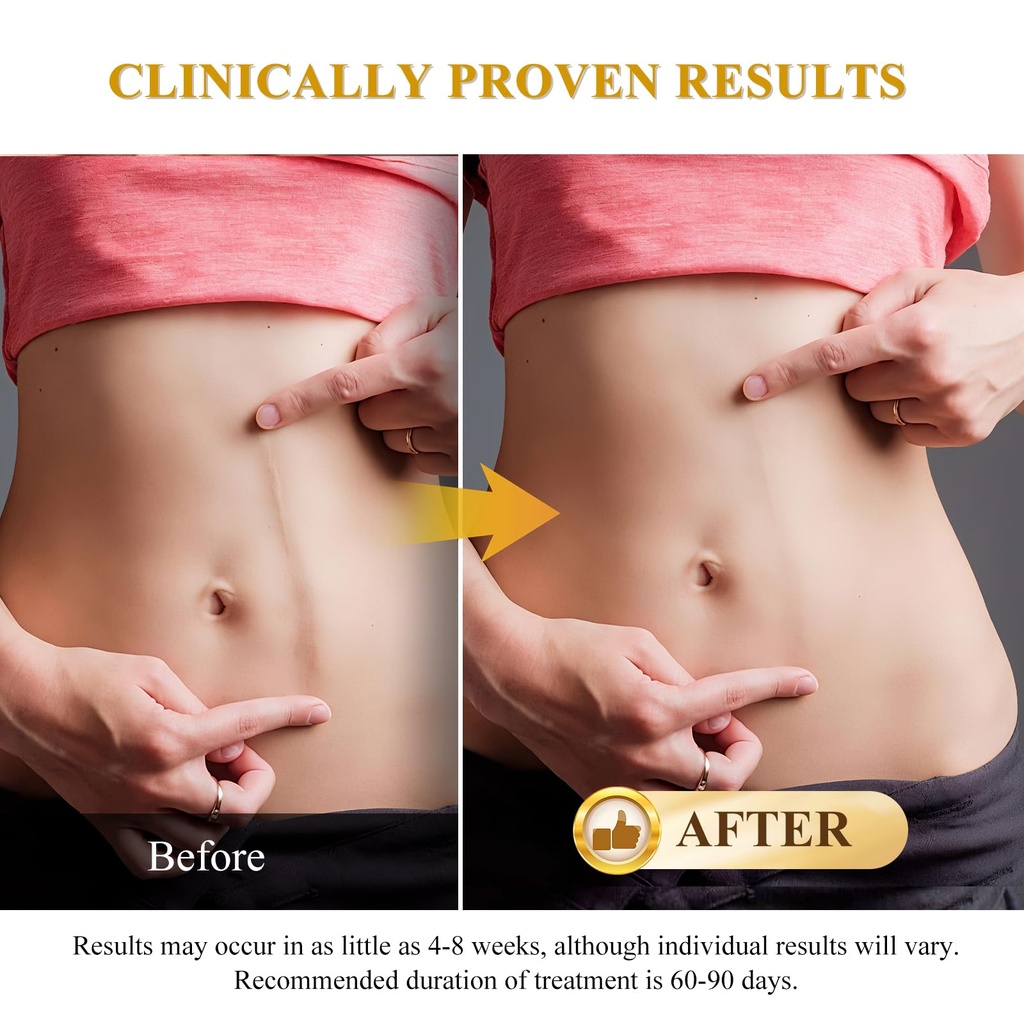 scar-cream-silicone-scar-gel-scar-cream--4.jpg