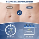 rvlaim-100-silicone-scar-gel-scar-cream--4.jpg