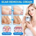 scar-cream-silicone-scar-gel-professiona-3.jpg