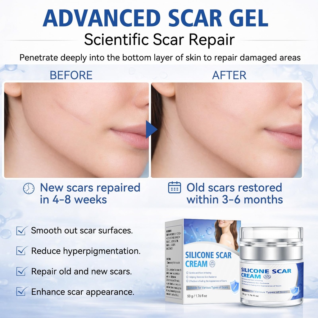 scar-cream-advanced-silicone-scar-gel-pr-4.jpg