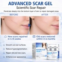 scar-cream-advanced-silicone-scar-gel-pr-4.jpg