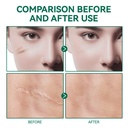 scar-gel-scar-removal-cream-scar-treatme-5.jpg