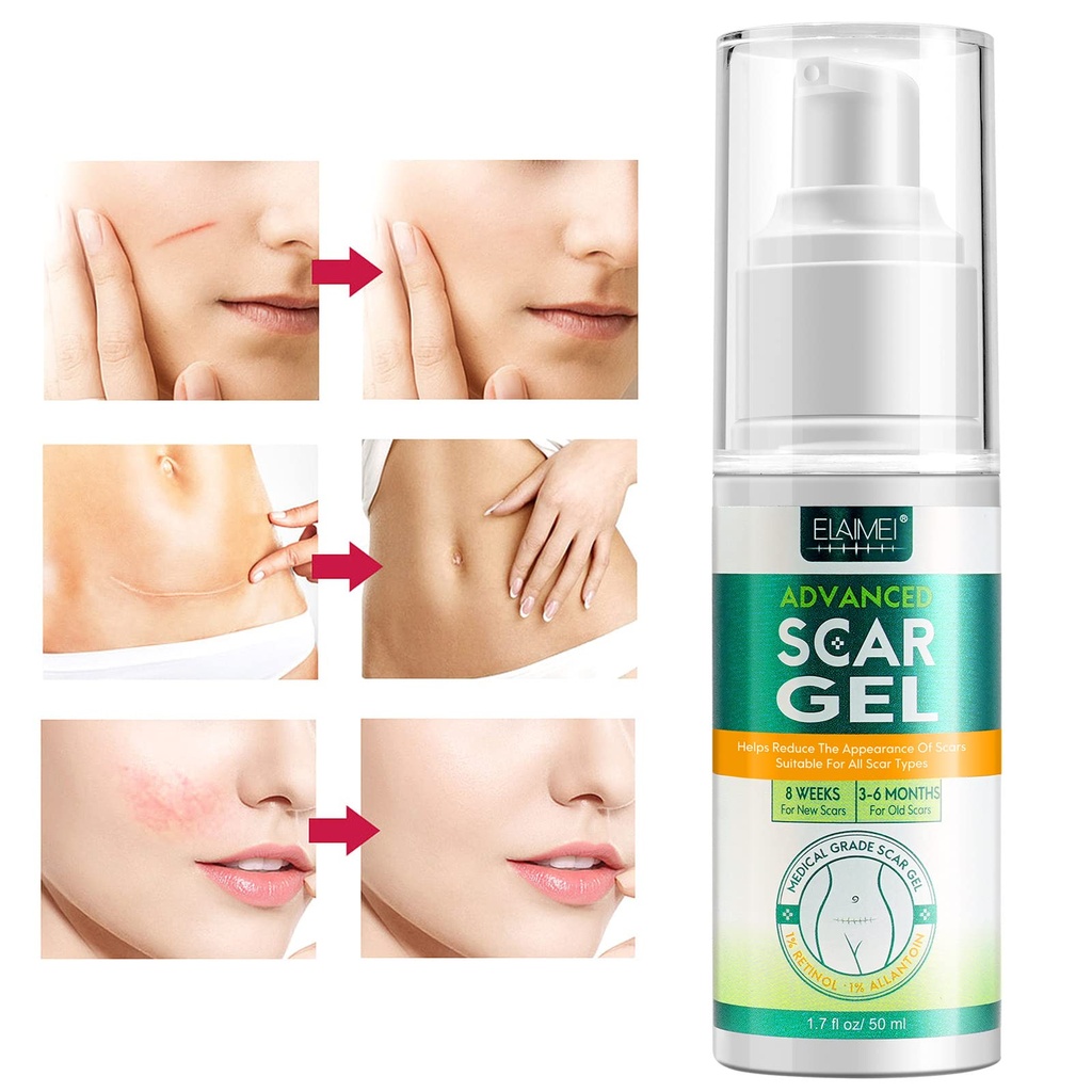 scar-gel-scar-removal-cream-scar-treatme-2.jpg