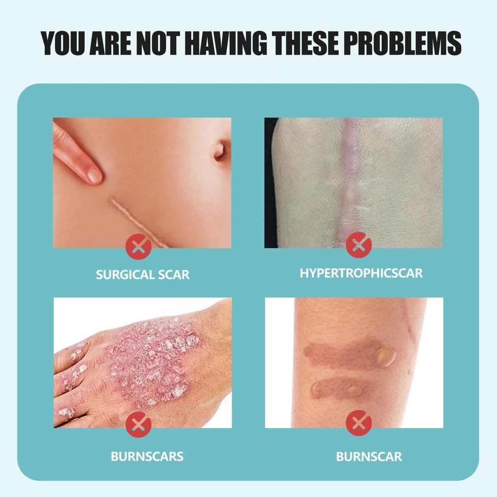 silicone-scar-gel-for-old-new-scars-redu-2.jpg
