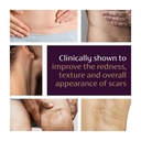 mederma-advanced-scar-gel-1x-daily-reduc-5.jpg