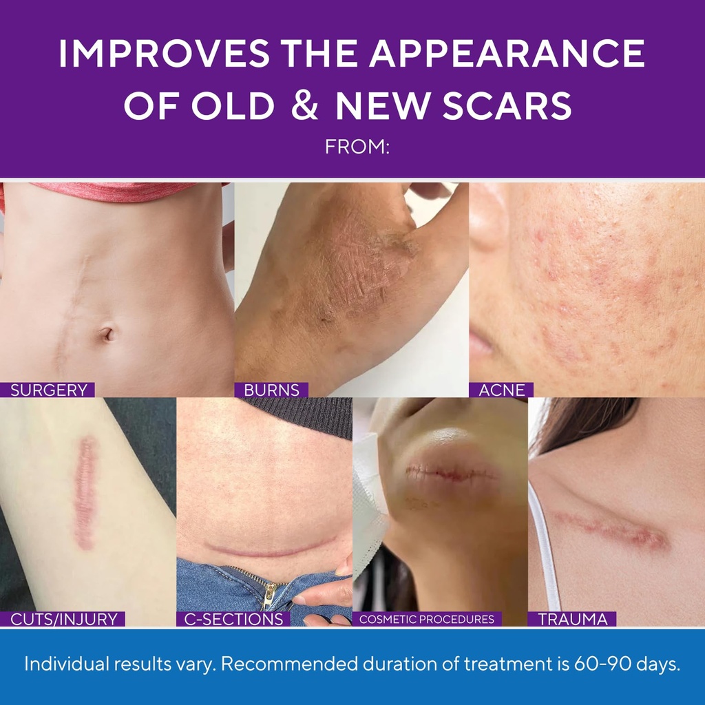 advanced-scar-gel-silicone-scar-gel-scar-6.jpg