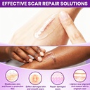 frankos-scar-gel-for-surgical-scars-soft-2.jpg