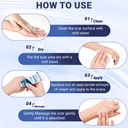 scar-cream-silicone-scar-gel-advanced-sc-6.jpg