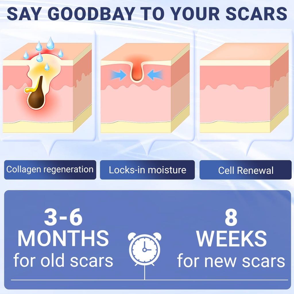 scar-cream-silicone-scar-gel-advanced-sc-4.jpg