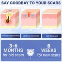 scar-cream-silicone-scar-gel-advanced-sc-4.jpg