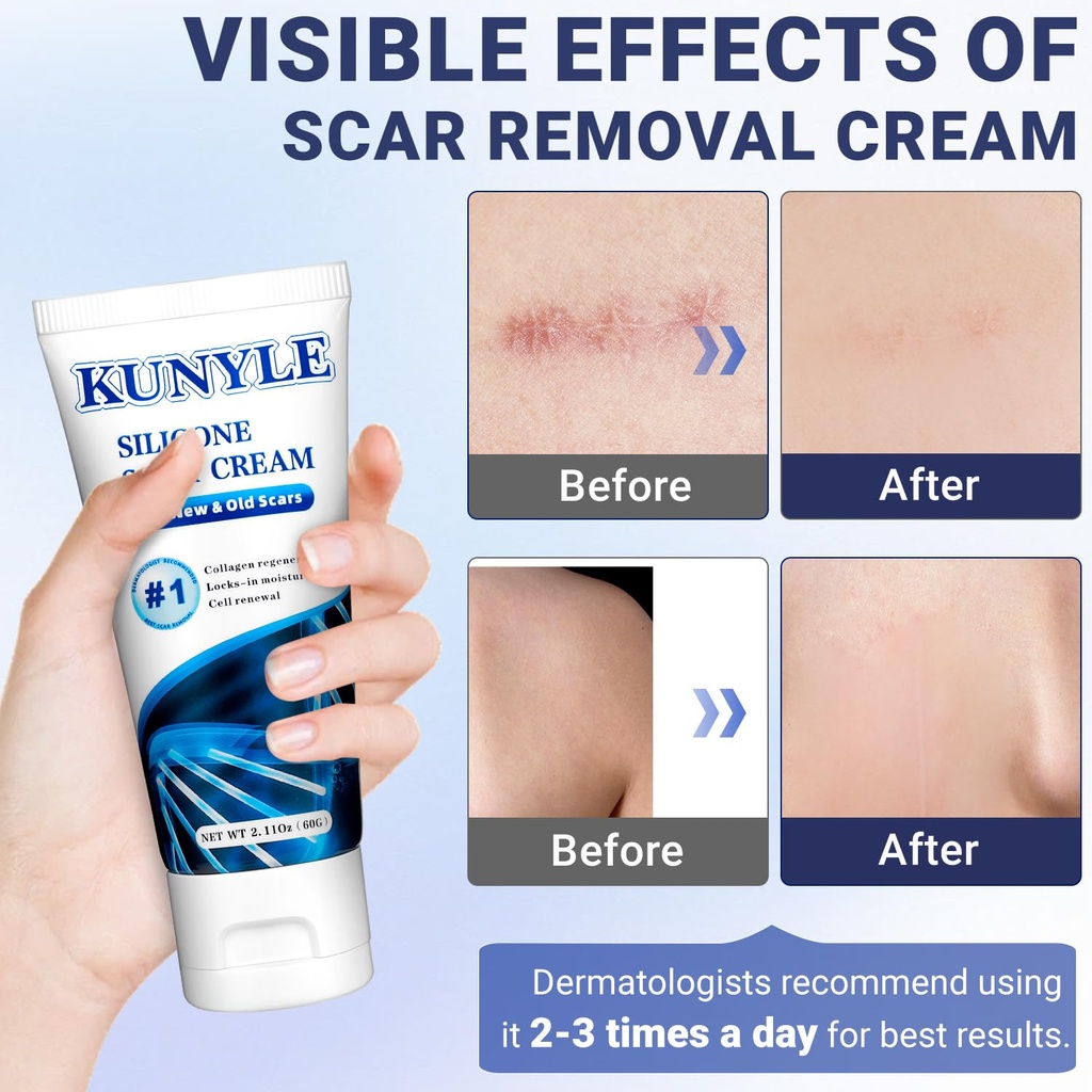 scar-cream-silicone-scar-gel-advanced-sc-2.jpg