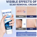 scar-cream-silicone-scar-gel-advanced-sc-2.jpg