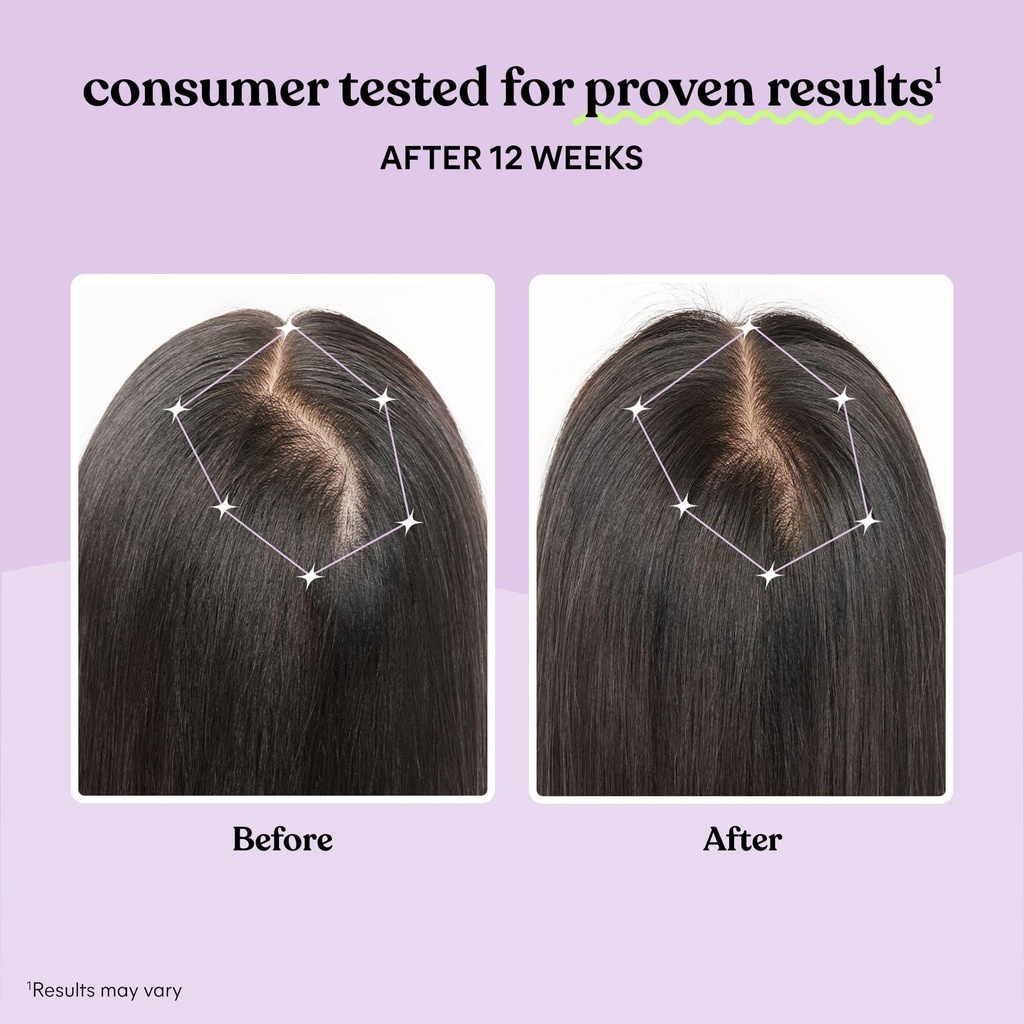 lemme-grow-hair-growth-capsules-for-wome-4.jpg