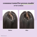 lemme-grow-hair-growth-capsules-for-wome-4.jpg