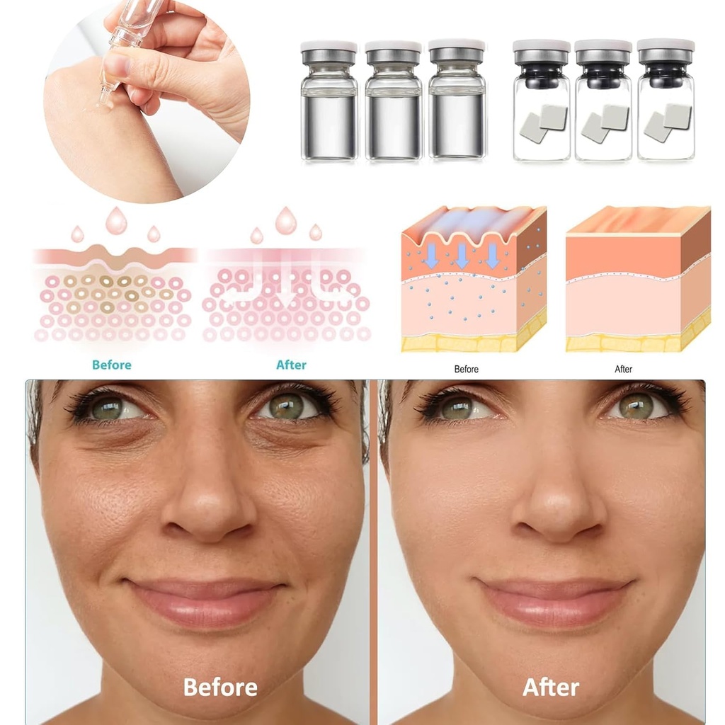 egf-skin-revitalizing-serum-sets-emergen-4.jpg