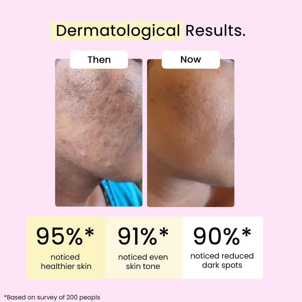 skin-glow-supplement-for-healthy-and-glo-6.jpg