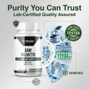 probase-nutrition-saw-palmetto-herbal-su-3.jpg