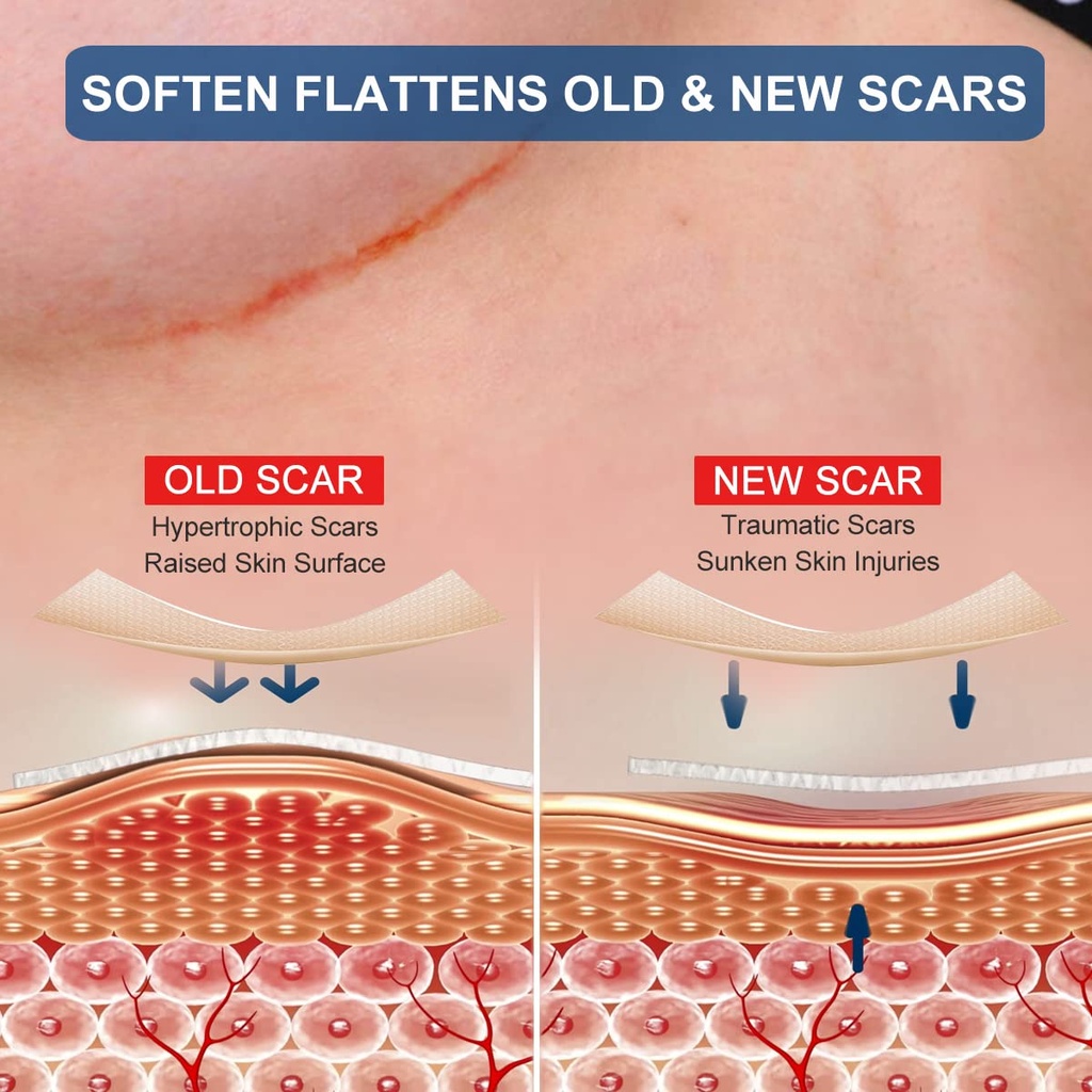 silicone-scar-sheets-for-breast-8-pack-i-2.jpg