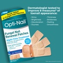opti-nail-fungal-nail-renewal-patches-21-4.jpg