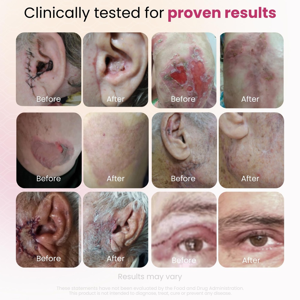 cica-glocalcare-clinical-grade-skin-reco-4.jpg